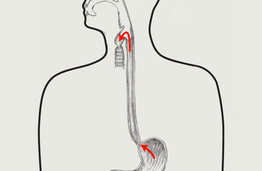 pepsin